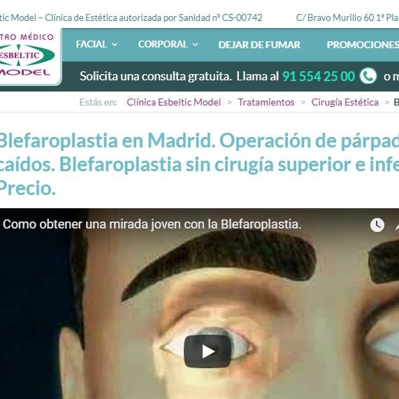 Blefaroplastia en Madrid
