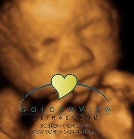 GoldenViewUltrasound