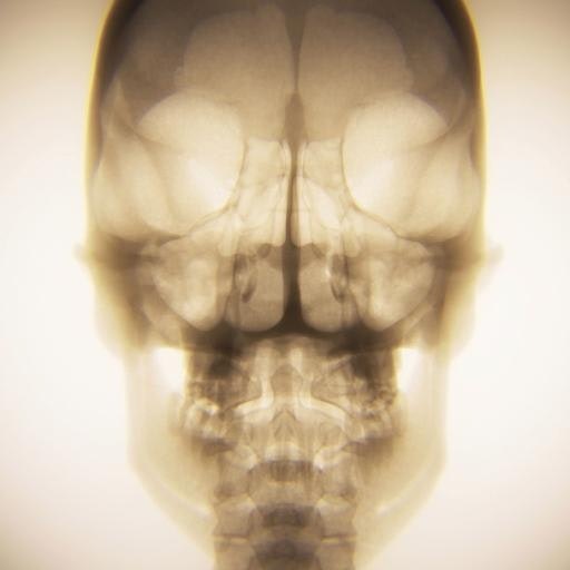 Hybrid Medical Animation