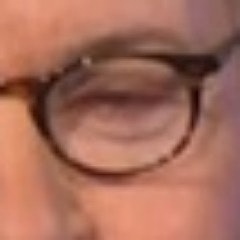 Bob Costas' Pink Eye