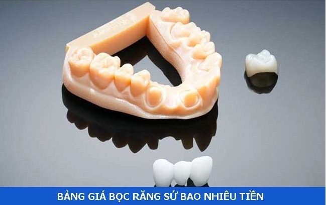 Giá Bọc răng sứ