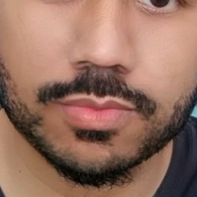 Miracle🏆Free Tag🏆