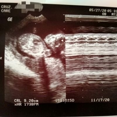 Nhing2x Cruz #💙💙💙 🙏😇 💞💙