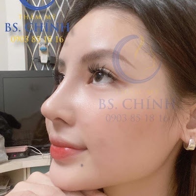 Thẩm Mỹ Bác Sĩ Chính