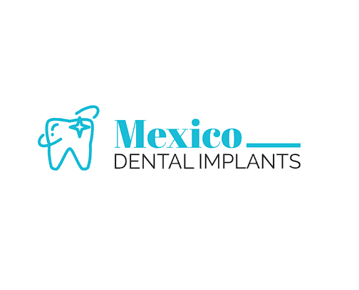 Mexico Dental Implants