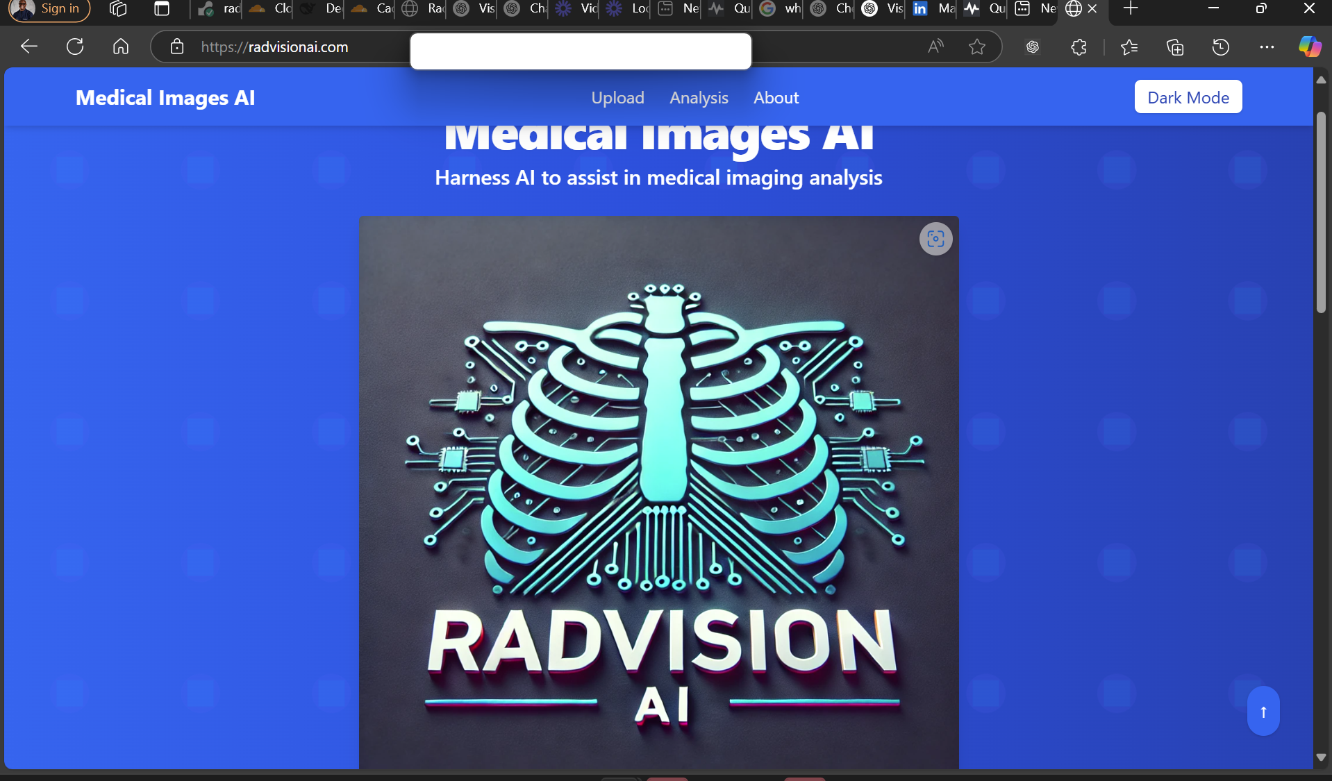 RadVision AI