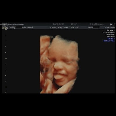Ultrasound scan