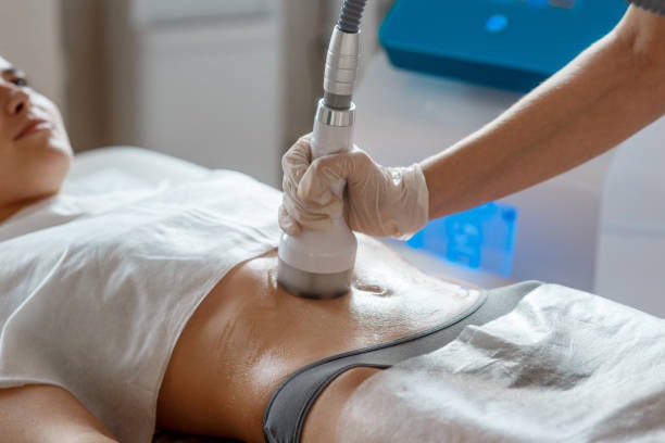 laser liposuction in Riyadh