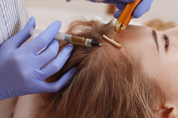 PRP Hair Treatment in Riyadh