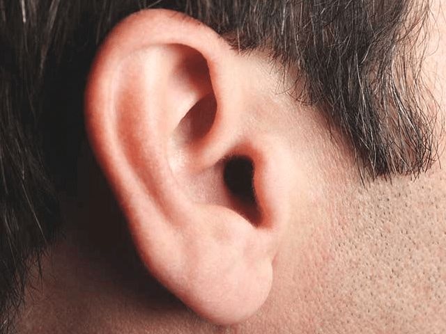 Ear Reshaping Surgery in Riyadh