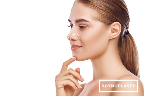 My experience with rhinoplasty in Riyadh