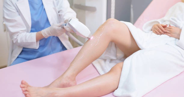Laser Hair Removal 