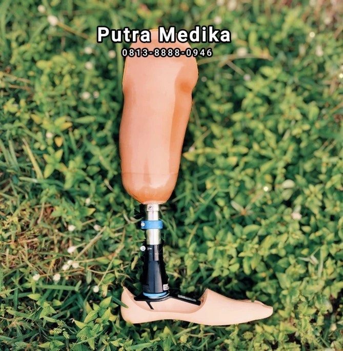 Putra Ortopedi